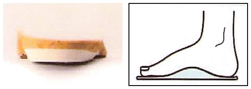 適応症例＜1＞イメージ