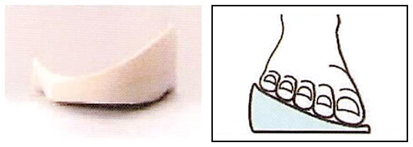 適応症例＜2＞イメージ